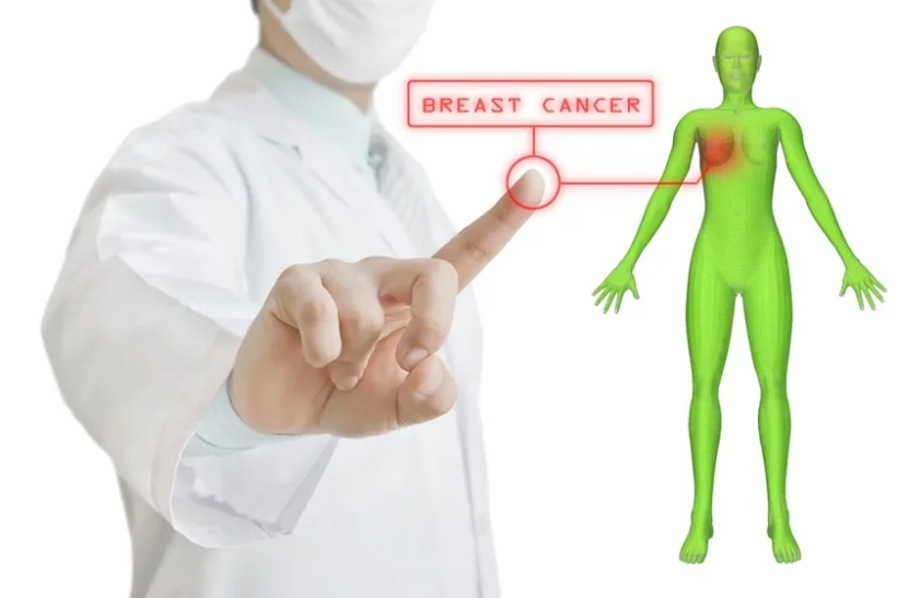 Cel mai frecvent tip de cancer este, în prezent, cancerul mamar