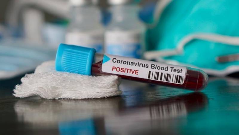 Militar român, confirmat pozitiv cu noul coronavirus
